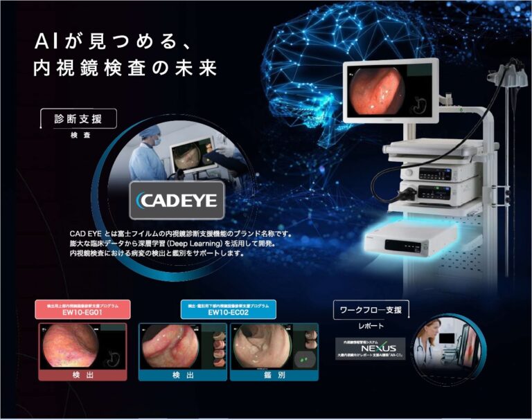 内視鏡画像診断支援システム CAD EYE™（キャドアイ) を導入しました | トリイクリニック 蒲郡市